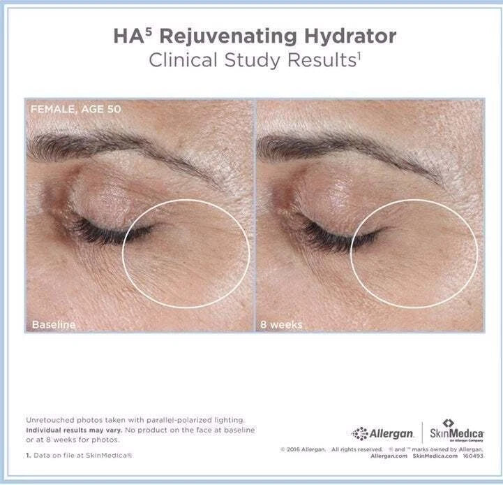 New Sealed SkinMedica HA5 Rejuvenating Hydrator - 2 oz.~ Authentic