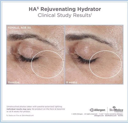 New Sealed SkinMedica HA5 Rejuvenating Hydrator - 2 oz.~ Authentic
